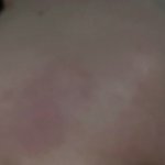 [ㅈㄱㄴ] 나 <b>생리전</b>인데 얼굴일케됌