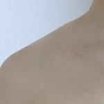 [댓글부탁해] 내 어깨 승모근관리랑 다이어트해도 <b>직각</b> 불가능이지...