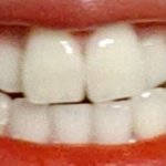 [댓글부탁해] 내 <b>덧니</b> ㅇㄸ