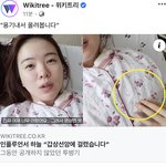 [드루와] 헐 <b>하늘</b> 갑상선암이래