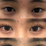 쌍수했더니 <b>스즈</b>됨
