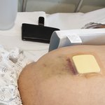 [방탈죄송] 담당 교수의 무단 이탈로 인해 식물인간이 된 저희 할아버지를...