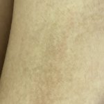 [댓글부탁해] 얘들아 허벅지 이거 <b>착색</b>이야?(털주의)