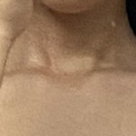 [댓글부탁해] 승모근 운동 일주일찬데 봐줘