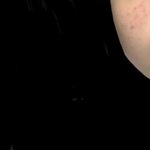 여드름 없애는 법 아는 사람 ㅠㅠㅠㅠㅠㅠㅠㅠㅠㅠㅠㅠㅠ