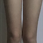 [19] <b>골반</b> 없어서 무릎끼리 붙는거야???