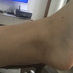 [댓글부탁해] 나보다 두꺼운 <b>발목</b> 나오셈