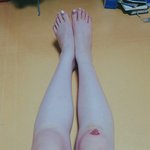 다리<b>상처</b> 흉질까??
