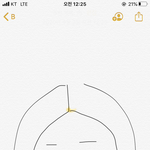 [댓글부탁해] 이마쪽 <b>비듬</b>