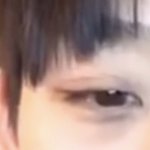 수술로 눈꼬리 이렇게 올릴 수 잇음?