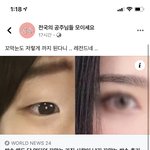<b>꼬막눈</b> 쌍수 쓰니 페북에서 벌써 퍼갔다