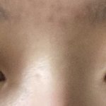 [댓글부탁해] 코 예쁜 사람들은 복받은 줄 알아