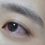 나 눈비볐더니 <b>핏줄</b> 다터짐