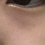 [댓글부탁해] 야 나 다크<b>서클</b> ㄹㅈㄷ임