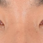 <b>남자성형</b>