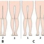 [댓글부탁해] 얘들아 너네 무릎도 이래?ㅜㅜ