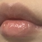 [댓글부탁해] 나 <b>윗입술</b> 왜이래???ㅜㅠㅠ