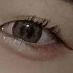 [댓글부탁해] <b>무쌍</b>인데 쌍수ㅠㅡㅠ