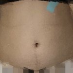 5kg 다이어트 <b>전후</b>