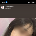 [드루와] 인스타 <b>광곤</b>데 여드름 합성 같지않냐