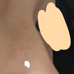 [19] 나 메<b>부리</b>코 심함??