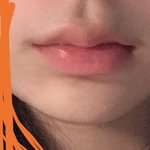턱이 짧은 게 <b>콤플렉스</b>야