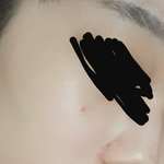 [댓글부탁해] 얘들아 <b>코에</b> 이런거 어케없애..