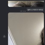[이것좀봐줘] 나 20살인데 탈<b>모야</b>