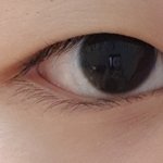 [꼭조언부탁] 나 <b>쌍수</b>하려는데
