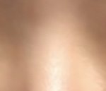 [댓글부탁해] 미간길이 3.7<b>센치</b> 앞트임할말