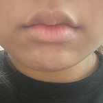 내 <b>입술</b> ㅈㄴ 빡치네