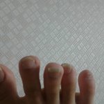 나 <b>발가락</b> 짱길쥐