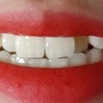 [댓글부탁해] <b>덧니</b> ㅇㄸ