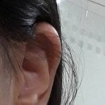 [드루와] 이거 귀 곪은거야? ㅠㅠㅠㅆ1ㅍ