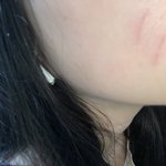 [드루와] 어제부터 알 수 없는 <b>상처들</b>이 계속 생겨 ㅠㅠ