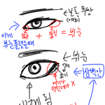 뷔눈과 보통 <b>무쌍</b> 눈 비교
