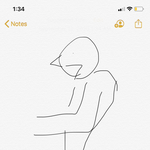 이거 척추측만증임?