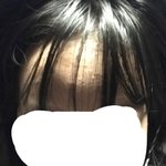 4일안씻음 + 밀가루 쳐먹어서 여드름 <b>오짐</b>