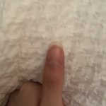 내 <b>엄지</b>손톱 ㅆㅂ