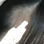 [드루와] 나 혹시 탈모야 시1발?