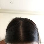 [댓글부탁해] 얘들아 이거 <b>탈모</b> 맞지...?ㅠㅠ