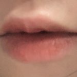 나 <b>윗입술</b>이
