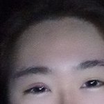 [이것좀봐줘] 혐)눈에뭐가났는데좀봐줘;