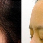 [이것좀봐줘] 나 이마 딱 이런데 앞머리 <b>유무</b>결정좀