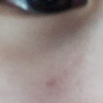 <b>피부</b>가 너무 안좋아 도와줘