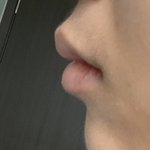 [댓글부탁해] 나 교정해야 되나?
