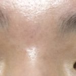 [꼭조언부탁] 내년에 <b>쌍수</b>하는데 괜찮은 눈인지 봐줘