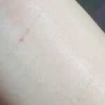 [댓글부탁해] 이거 많이 자해 <b>흉터</b> 같냐??????
