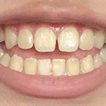 나 오늘 치아<b>미백</b>치약 샀는데 효과 바바