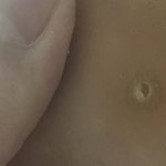 no혐) 나 티눈 <b>샤프</b>로 파냄 ㅋㅋㅋㅋㅋ사진ㅇ